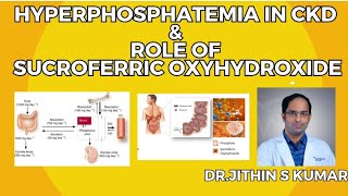 HYPERPHOSPHATEMIA IN CKD amp ROLE OF SUCROFERRIC OXYHYDROXIDE  DRJITHIN S KUMAR [upl. by Enellij544]