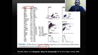 Interpretação do Hemograma [upl. by Ettore]