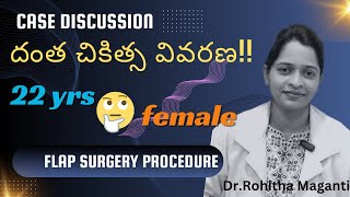 Case discussion  Flap procedure [upl. by Mora]