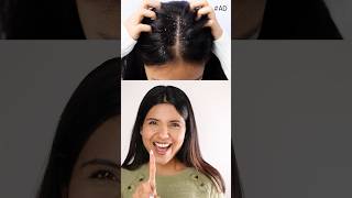 How to deal with Dandruff  Winter Hacks  Niharika Jain [upl. by Aihseket181]