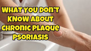 What They Dont Tell You About Chronic Plaque Psoriasis [upl. by Yllah]