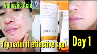 Day 1 Salicylic Acid effective ba [upl. by Park]