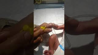 Newborn baby after birth cannula motivation youtubeshorts video viralshorts nursing work gnm [upl. by Orutra]