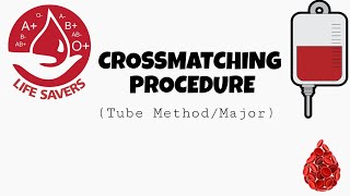 Crossmatching Procedure  Tube methodMajor [upl. by Thurber]