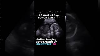 Gender Reveal jerbearimaging 20weekspregnant girlorboy genderreveal [upl. by Dorrehs]