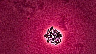 Lactobacillus  Time Lapse Photography [upl. by Farhi]