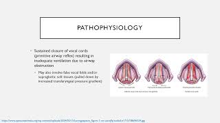 Common Perioperative Complications Keyword Review  Dr Green [upl. by Hamlen]