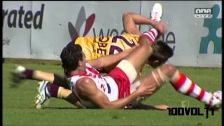 Jaymie Graham Former West Coast Player WORST leg break youll EVER SEE [upl. by Aita]