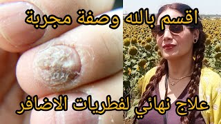 علاج طبيعي لفطريات الاظافر mycose des ongles بسرعة متنسايش دعي معايا بعد الوصفة [upl. by Asirb]