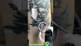 TwoStep Tattoo Removal CO2 Laser amp PicoSecond Laser Explained [upl. by Enilorak]