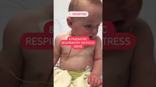 8 Pediatrics Respiratory Distress ☢️ parentingtips newparents respiratorydiseases paediatric yt [upl. by Wooldridge130]