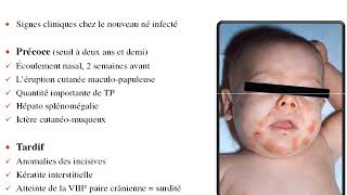 NEONATOLOGIE  cours 1  mécanisme et prévention des infections du nouveau né [upl. by Luht]