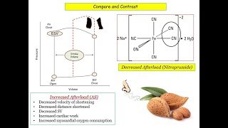 12DaysinMarch Valvular Heart Disease 7 Aortic Stenosis for the USMLE Step One Exam [upl. by Derreg]