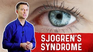 What is Sjogrens Syndrome Understanding Sjogrens Syndrome Symptoms – Dr Berg [upl. by Elaweda]