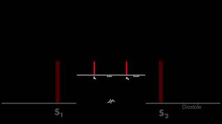 Normal Heart Sounds [upl. by Fuchs820]