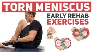 Meniscus Tear  Start With These Rehab Exercises [upl. by Etrem]