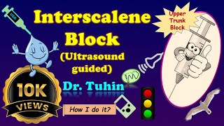 Interscalene Brachial Plexus Block  Ultrasoundguided  Upper Trunk Block  ISB  Anatomy Review [upl. by Aneen784]