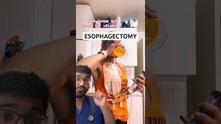 DOCTOR REACTS to ESOPHAGECTOMY and ESOPHAGOSTOMY [upl. by Gayner577]