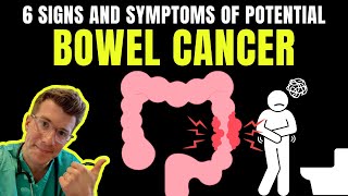 6 SIGNS AND SYMPTOMS OF BOWEL CANCER [upl. by Rodolphe]