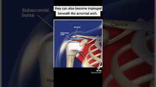 Subacromial bursitismedical medicines medicalstudent medicaleducation definition physiotherapy [upl. by Brookhouse]