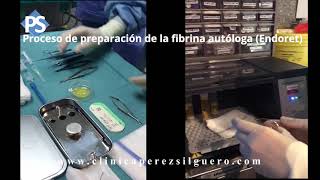 Fibrina  Endoret  y queratitis ulcerativa periférica PUK [upl. by Sirovaj]