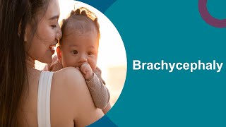 Brachycephaly Positioning for your baby [upl. by Conias]