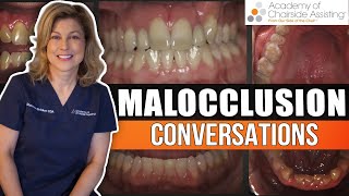 How to understand what is occlusion and have malocclusion conversations [upl. by Nedry889]