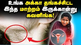 PCOD amp PCOS Symptoms amp Treatment in Tamil ஆண்பெண் தெரிந்து கொள்ளவேண்டிய பெண்களை பற்றிய விஷயங்கள் [upl. by Ratep]