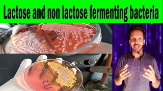 Lactose and non lactose fermenting bacteria  MacConkey agar Clear explanation [upl. by Forster116]