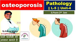 Osteoporosis  Pathology  L5 Unit 4 for BPharm 2nd Sem [upl. by Amathiste]