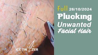 Beard Plucking with Tweezers  PCOS Female Facial Hair Removal [upl. by Ahsitahs741]