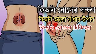 কিডনি রোগের লক্ষণ  কিডনির সমস্যা  Symptoms of kidney disease in Bangla  Rasel Bangla Health Tips [upl. by Angy]