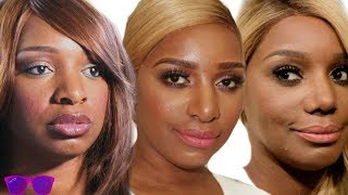 Nene Leakes Transformation and Plastic Surgery  Tinted TV [upl. by Prosser]