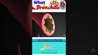 What is Bronchitis I Causes Of Bronchitis I Gaseous Exchange I Biology [upl. by Linette532]