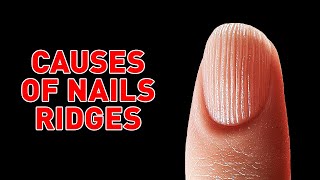 Causes of Ridged Nails and How to Avoid Them [upl. by Louise]