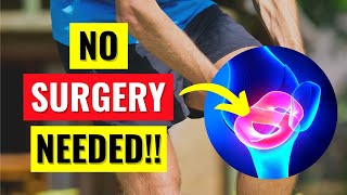 Why You Dont Need Surgery For Your Meniscus Tear [upl. by Pelag]