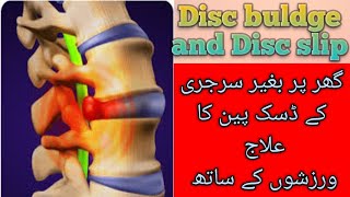 Backpain treatment by dr warda  S6  Exercises for disc pain  UrduHindi [upl. by Ylimme]