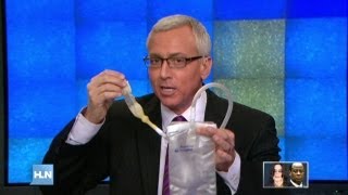 Dr Drew examines Michael Jacksonâs autopsy report [upl. by Neehcas13]