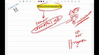 Pheochromocytoma [upl. by Ruamaj443]