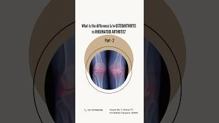 Osteoarthritis VS Rheumatoid Arthritis physiotherapist physionearme drdeepanjaliverma [upl. by Revilo116]