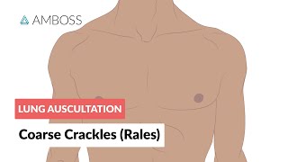 Coarse Crackles Rales  Lung Auscultation  Episode 3 [upl. by Onitnatsnoc190]