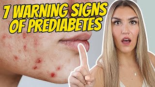 7 Early Warning Signs of Prediabetes You Cant Ignore [upl. by Peppel]