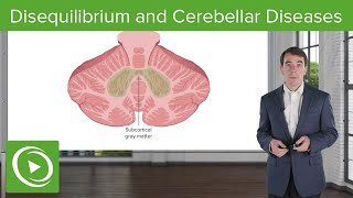 Disequilibrium and Cerebellar Diseases [upl. by Everest651]