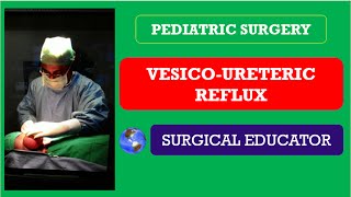 VESICO URETERIC REFLUX How To DIAGNOSE amp TREAT Pediatric Surgery [upl. by Mill289]