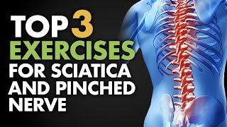 Top 3 Exercises for Sciatica and Pinched Nerve [upl. by Lambert]