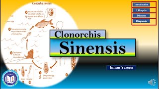 Clonorchis sinensis causes hyperplasia amp fibrosis of biliary tract  Parasitology  by Imran Yaseen [upl. by Ferree]