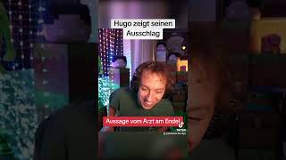 Hugo zeigt seinen Ausschlag im Stream letshugo stegi twitchde [upl. by Hilbert]