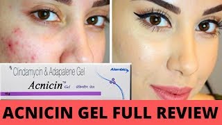 ACNICIN GEL FULL REVIEW UNBOXING AND TEXTING BEST FOR ACNEपिम्पल्स गया होंगे मेरी गॅरंटी [upl. by Presley843]