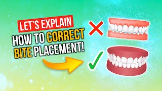 What Is A Correct Bite  Correcting Overbites Underbites Buck Teeth amp MORE [upl. by Ydnyc497]