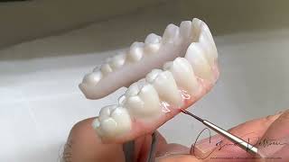 Implant Bridges Zirconia Monolithic Double Full Arch Tutorial [upl. by Lathrop635]